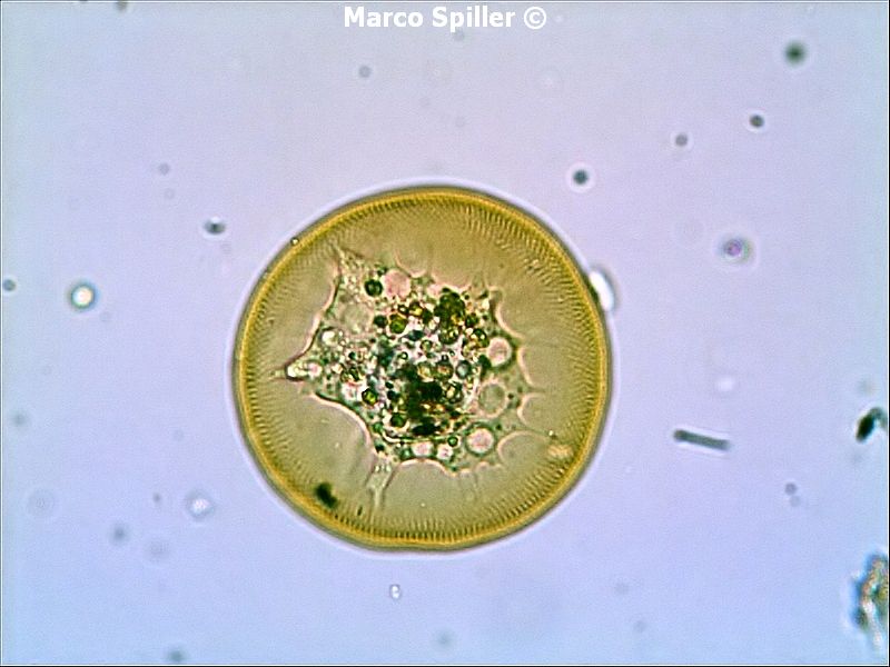 Arcella vulgaris - foto e video